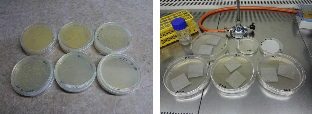 Determinación del número de colonias bacterianas (arriba) para la inoculación de las probetas de ensayo (abajo). AIDIMME